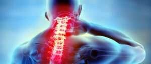 Whiplash schadevergoeding