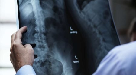 Schadevergoeding medische fout aanvragen Schadevergoeding medische fout